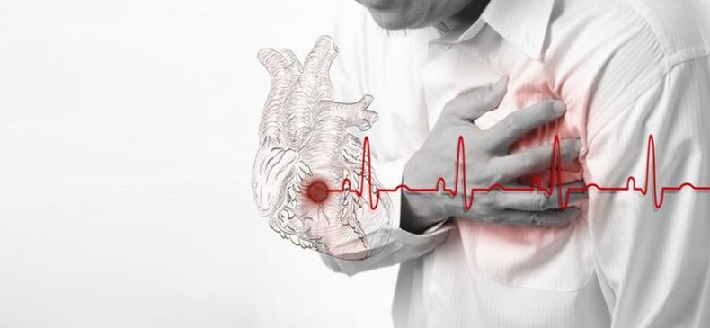 Herzinfarkt als Ursache für Schmerzen unter dem linken Schulterblatt