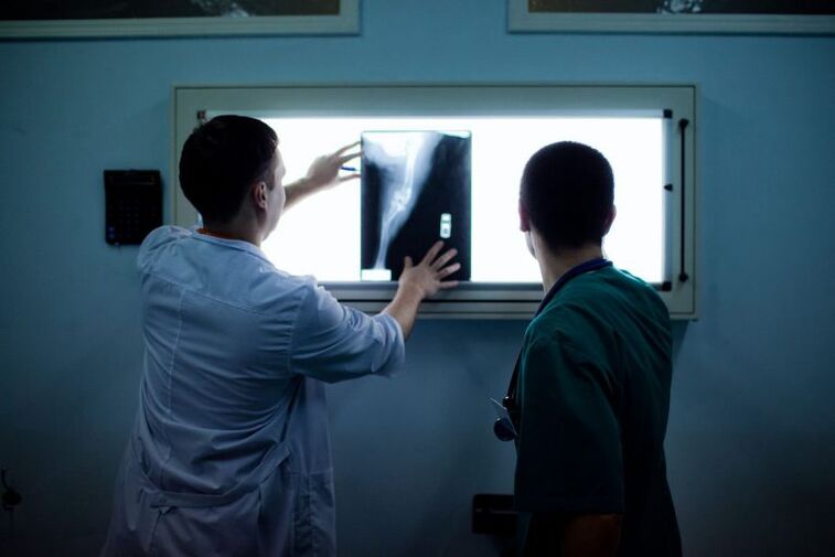 X -Ray osteoarthritische Diagnose