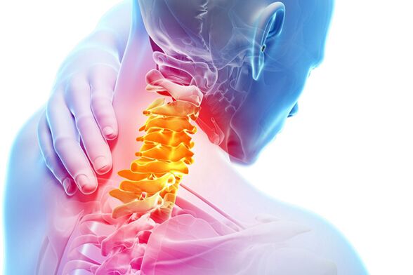 Zervikale Osteochondrose