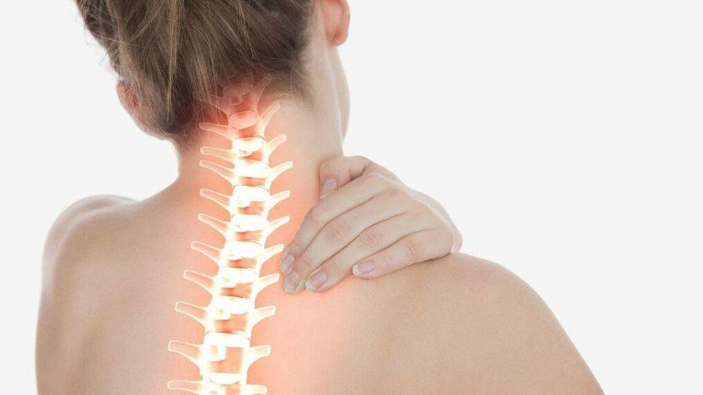 Bei einer Osteochondrose der Halswirbelsäule kann sich ein radikuläres Syndrom entwickeln.