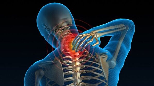 Schmerzen beim Drehen des Halses können auf ein Halswirbel-Osteochondrose-Syndrom hinweisen.