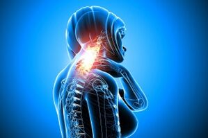 Osteochondrose in der Halswirbelsäule